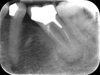 Truc bizarre wmzsbj - Eugenol