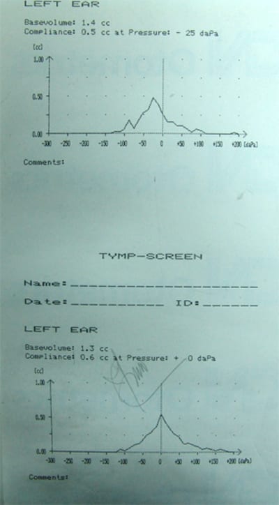 Tymp2 dihwy5 - Eugenol