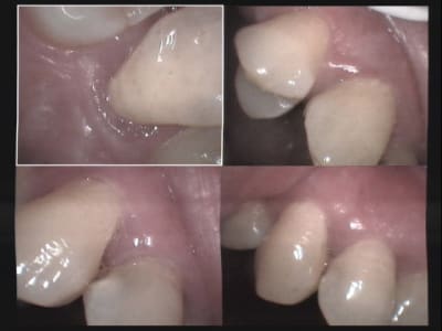 Un cas difficile bip bip 3 zxjmal - Eugenol