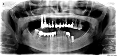 Untitled image vv pmwncx - Eugenol