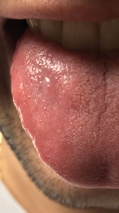 V0qyn5rnw6brecpvtz8u - Eugenol