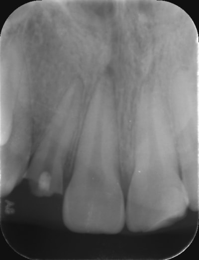 V2wetk1d6vhcayhrgajo - Eugenol