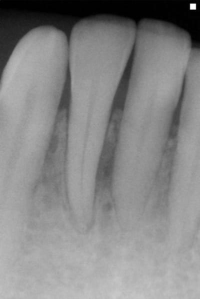 Verc déc06 hpkr3t - Eugenol