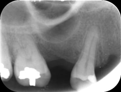 Vitte gzxyzk - Eugenol