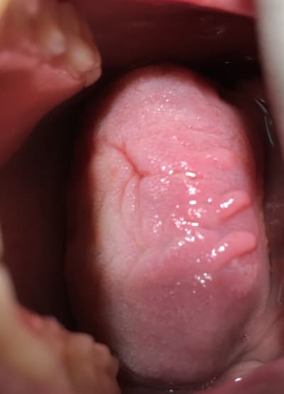 Vopxzyvsbonlli4fdkdz - Eugenol