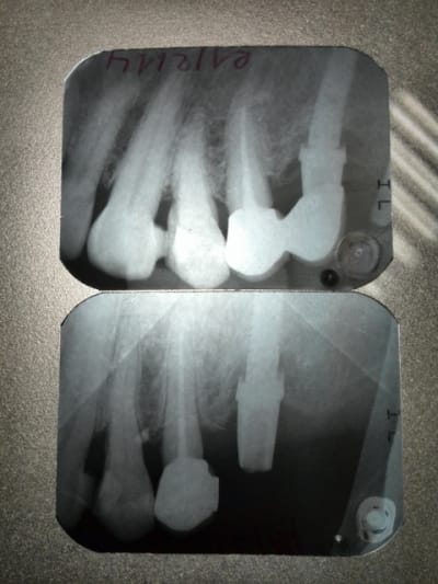Vp14 kqm1s0 - Eugenol