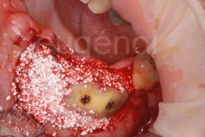 Vue1 ul3rti - Eugenol