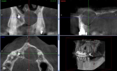 Vue 3 qw9dut - Eugenol