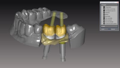 Vue v apr s r duction copie iuwrrb - Eugenol