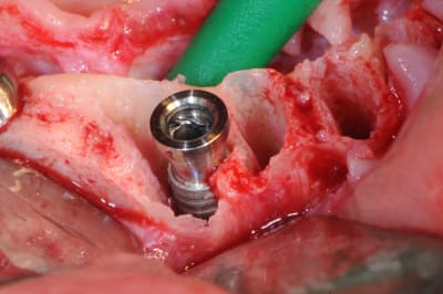 W1vifarwxnl67nxxv12f - Eugenol