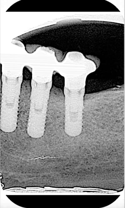 Whdxqe94jyogtmzyr1v1 - Eugenol