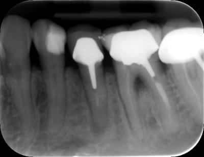 Wolff 1 phyick - Eugenol