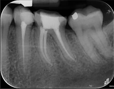 Wuogatnsdhospaghrmaf - Eugenol