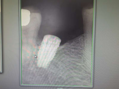 Wwnzj1rlspjd5y0hrm8x - Eugenol