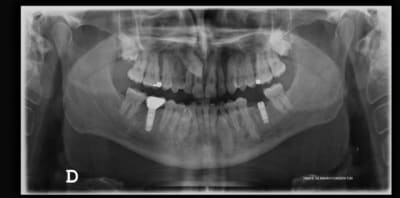 X vv7tfb - Eugenol