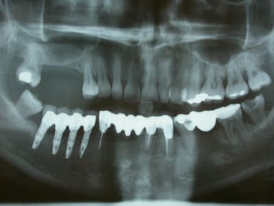 Xxx y9lj0b - Eugenol