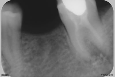 Yamen3 bghhfy - Eugenol
