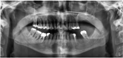 Zarbi knl4km - Eugenol