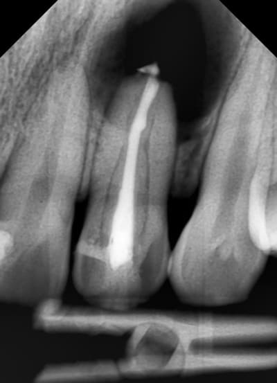 Zhou s7war5 - Eugenol
