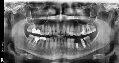 Zieo9qxikgkehsicbshg - Eugenol