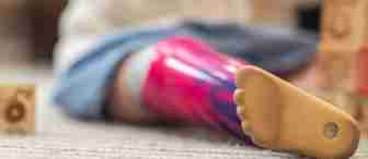 A close-up of a child's prosthetic leg with a colorful design. The child is sitting on the floor, playing with wooden blocks that are blurred in the background. The image captures the prosthesis from the foot up to the knee.