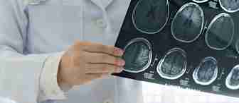 A doctor in a white coat, with a stethoscope around their neck, holds up and examines a series of brain MRI scans. The images show detailed views of the brain from different angles.