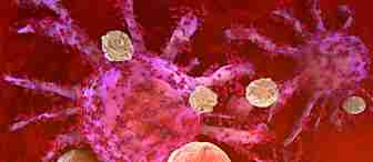 A detailed 3D illustration showing cancer cells under microscopic examination. The cells are depicted in vibrant red and purple hues with various sizes and shapes, surrounded by white blood cells, against a red background, representing the biological environment.