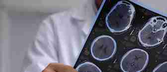 A person in a white lab coat examines an array of brain scans. The scans show various sections of the brain in grayscale, depicting different angles and slices. The person is holding the scans with both hands, focusing on the images.