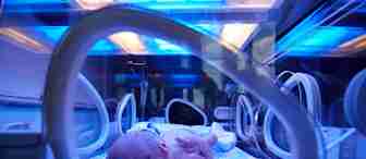 A newborn baby lies on its back inside an incubator under blue phototherapy lights, surrounded by medical equipment. The baby is covered with a small blanket and appears peaceful, receiving treatment likely for jaundice.