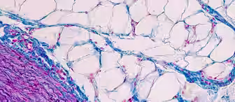 A microscopic image of connective tissue stained with Masson's trichrome. The image shows a mix of blue, red, and pink hues, displaying fibrous and adipose tissue. Blue staining highlights collagen fibers, while muscle and cytoplasm appear in shades of red and pink.