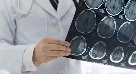 A doctor in a white coat, with a stethoscope around their neck, holds up and examines a series of brain MRI scans. The images show detailed views of the brain from different angles.