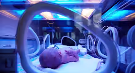 A newborn baby lies on its back inside an incubator under blue phototherapy lights, surrounded by medical equipment. The baby is covered with a small blanket and appears peaceful, receiving treatment likely for jaundice.