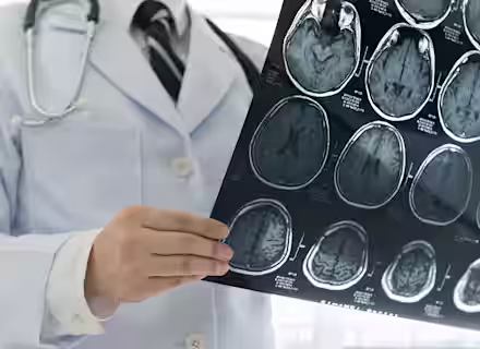 A doctor in a white coat, with a stethoscope around their neck, holds up and examines a series of brain MRI scans. The images show detailed views of the brain from different angles.