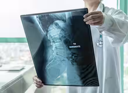 A doctor in a white coat holds up an X-ray image of a human spine in a bright medical office, with the word “STANDING” visible on the film.