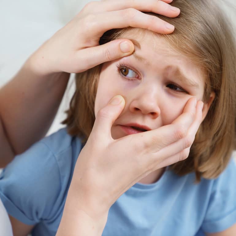 Eye inflammation in children