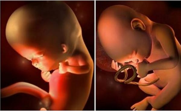 Mẹ bầu chịu khó chơi với thai nhi sẽ quyết định sự thông minh sau khi con chào đời - Sắt bà bầu