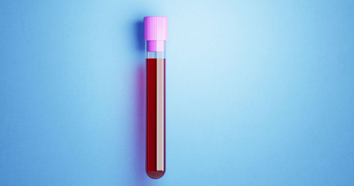 A Guide to Understanding Your Iron Levels Sharecare