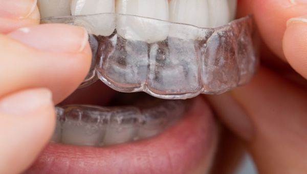 7 Surprising Bad Habits That Are Harming Your Dental Health