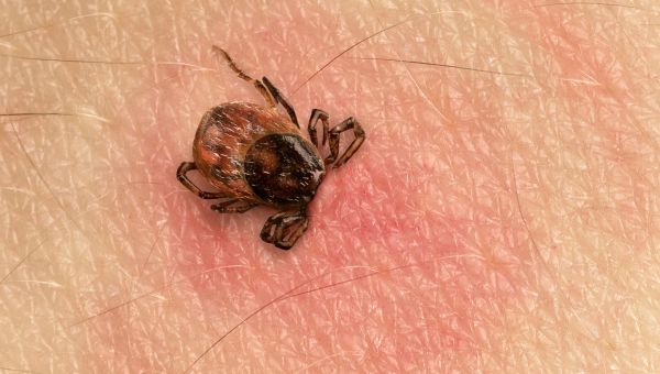 tick, tick bite, ticks, lyme disease, rocky mountain fever