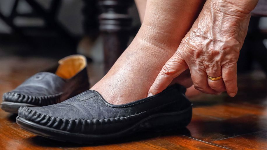 Senior woman putting on her flats
