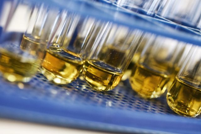 Test tubes with orange urine. Why is my pee orange instead of clear? That urine color means you need to drink more water. 