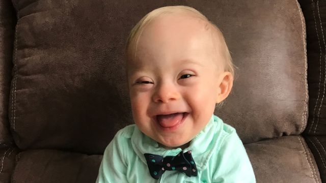 Meet Lucas The First Gerber Baby With Down Syndrome Sharecare