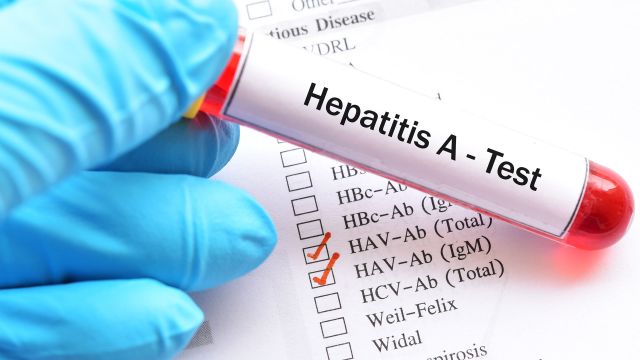 hepatitis a test