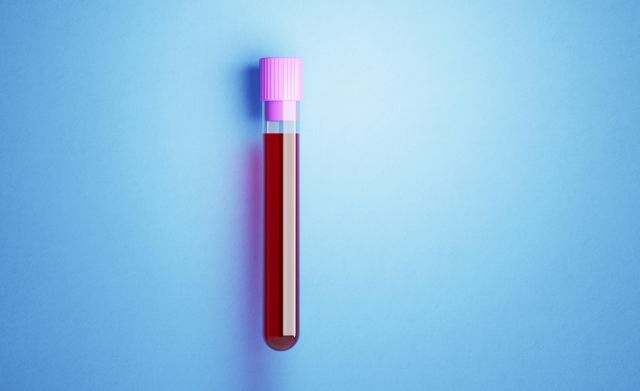 Blood tests can tell you quite a lot about your iron levels.
