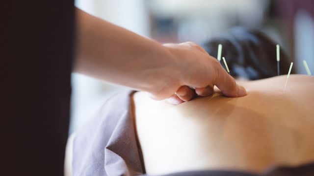 A person gets acupuncture treatment.