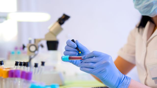 Woman labeling a blood sample