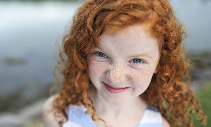 Are redheads with blue eyes really going extinct? | Pursuit by The  University of Melbourne