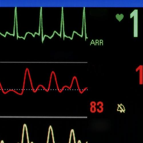 Enzyme that shows heart attack top