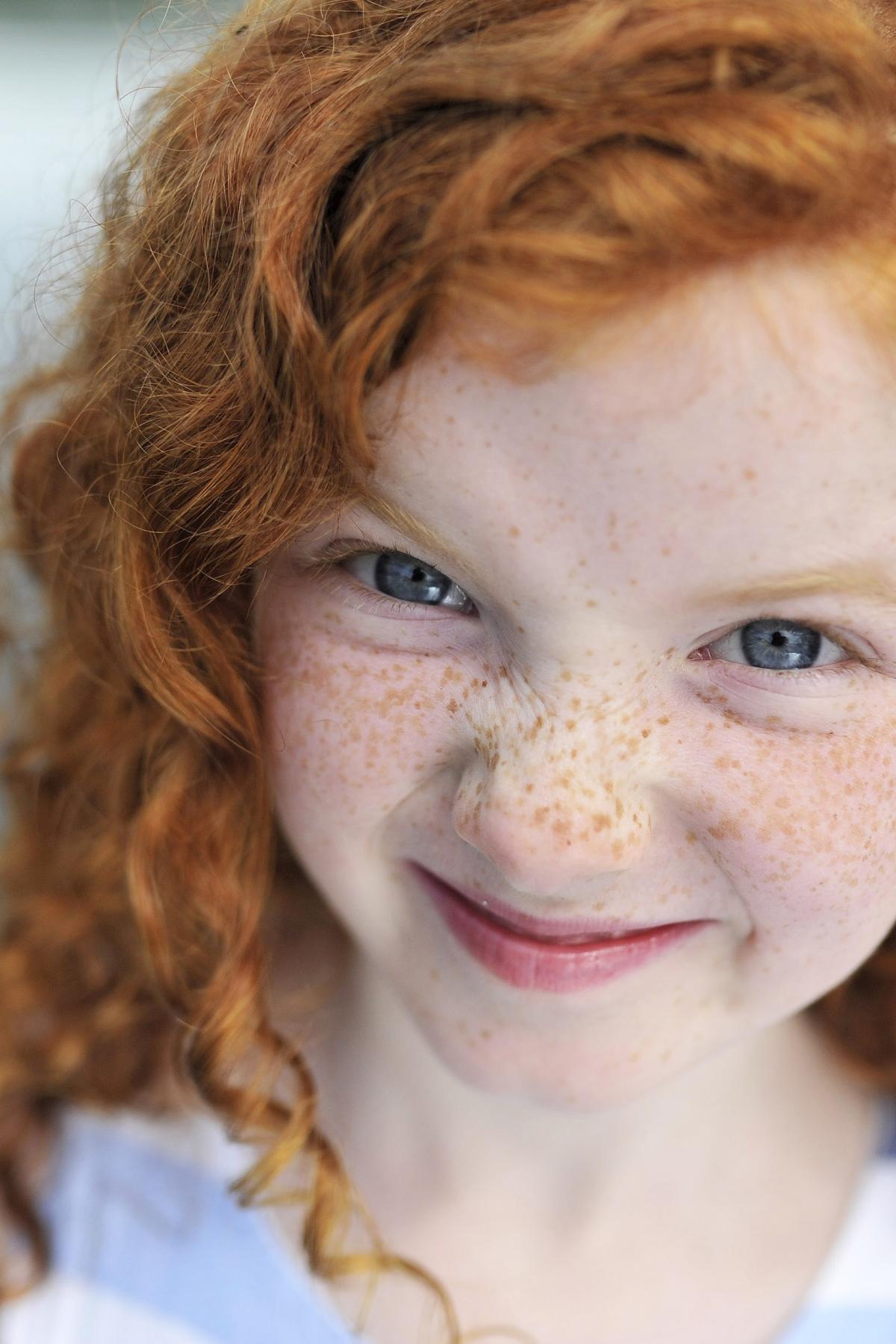 Are Redheads With Blue Eyes Really Going Extinct Pursuit By The University Of Melbourne