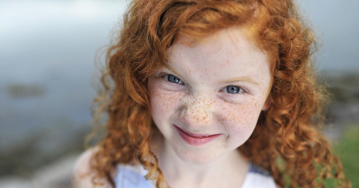 Are Redheads With Blue Eyes Really Going Extinct Pursuit By The 